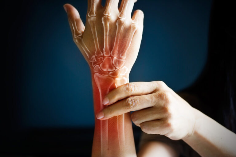 Alan B. Thomas MD PhD – Hand Surgery – Puget Sound Orthopaedics