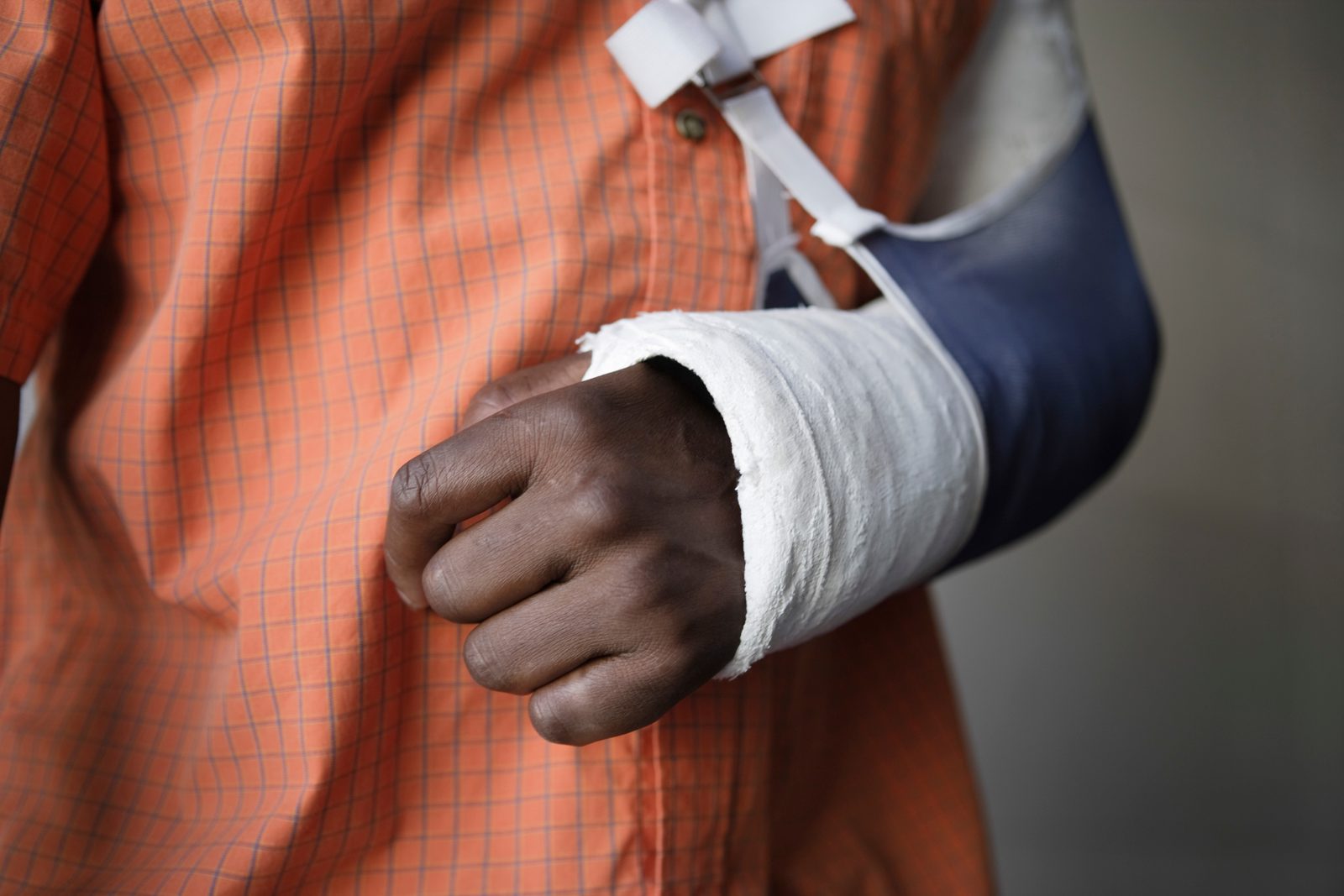 Cast Care Instructions: How to Care for Your Cast at Home